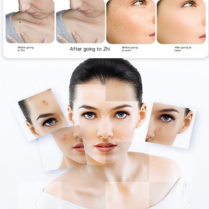 New Beauty Device Home Spot Removal Pen with LCD Display